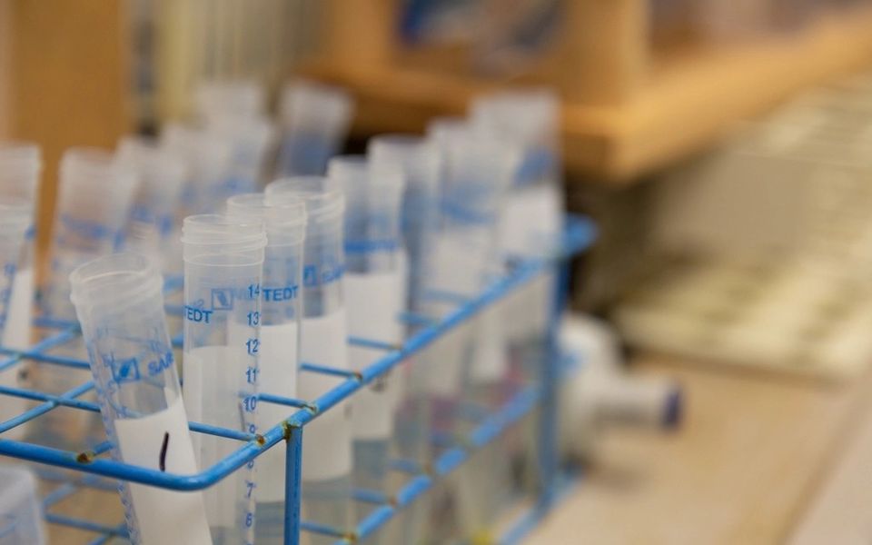 Sample tubes in a laboratory rack